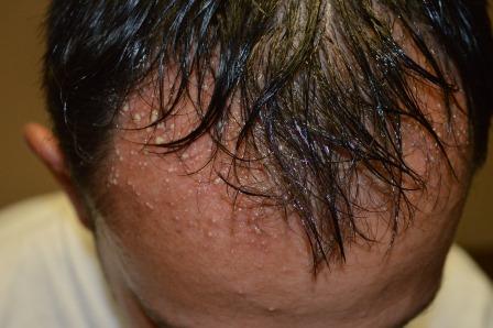 Itchy Scalp and Rash - treato.com